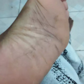 Aliyi