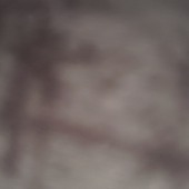 Freedug