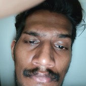 Giglo